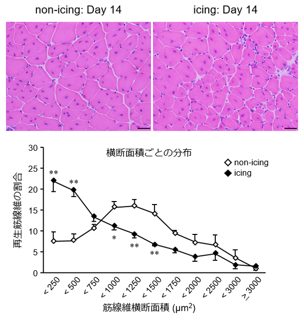 [情報] 日本研究  冰敷有可能減緩肌肉回覆速度