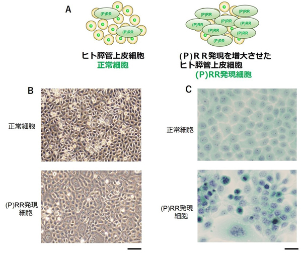 正常の膵臓の細胞が癌になる根本原因の一つを明らかに Research At Kobe