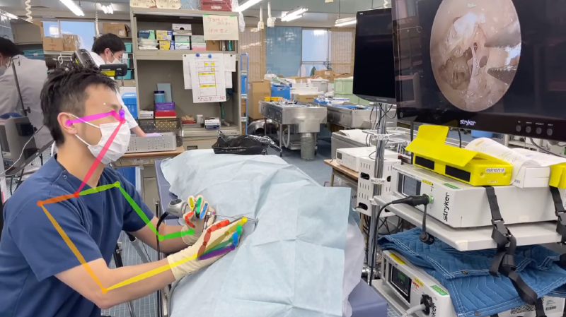 photo showing how the robot learns the surgeon's movements during ear surgery