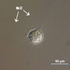 図1 ハリタイヨウチュウ Raphidiophrys contractilis